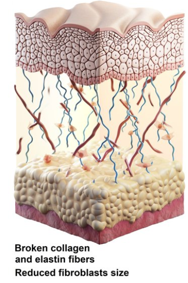 Structure of Elastin in the Dermis